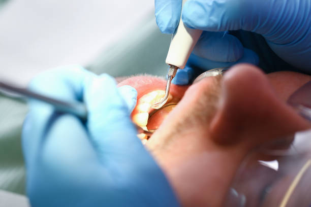 Best Orthodontic Emergency Dentist in Mountain Top, PA