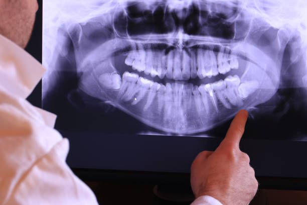 Best Emergency Root Canal Treatment in Mountain Top, PA